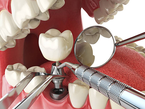 Best Walk-In Emergency Dental Services in Grant, NE